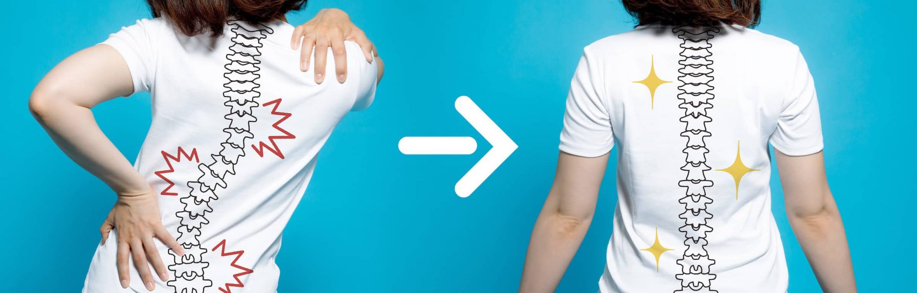South East Chiropractic: backpain due to misaligned spine.
